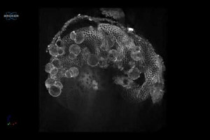 Cibicidoides wuellerstorfi with juveniles?